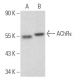 Nicotinic Acetylcholine Receptor epsilon/CHRNE Antibody (B-11) - Western Blotting - Image 374463