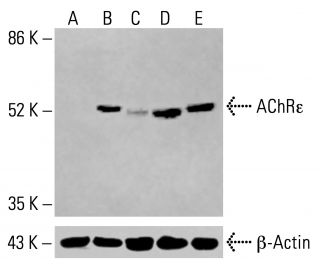 Nicotinic Acetylcholine Receptor epsilon/CHRNE Antibody (D-6) - Western Blotting - Image 414842 