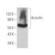 Aciculin Antibody (F-11) - Western Blotting - Image 366304