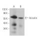 Aciculin Antibody (F-2) - Western Blotting - Image 368684 
