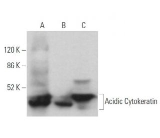 Acidic Cytokeratin Antibody (3G128) - Western Blotting - Image 379266 