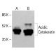 Acidic Cytokeratin Antibody (3G128) - Western Blotting - Image 413252