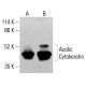 Acidic Cytokeratin Antibody (5F154) - Western Blotting - Image 413251