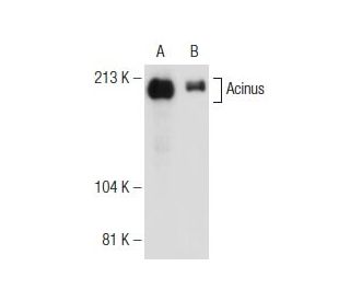 Acinus Antibody (2005C3a) - Western Blotting - Image 146338 