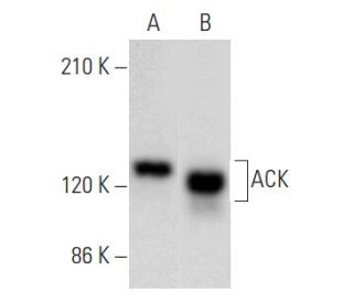 ACK Antibody (A-11) - Western Blotting - Image 354953