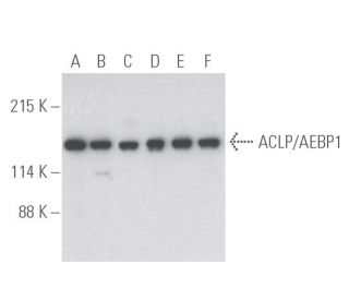 ACLP/AEBP1 Antibody (G-1) - Western Blotting - Image 398111Each CRISPR/Cas9 Knockout (KO) Plasmid product consists of a pool of 3 plasmids designed to ensure identification and cleavage of a specific gene for maximum knockout efficiency. Each plasmid encodes a unique 20 nt sequence derived from the GeCKO (v2) library.
