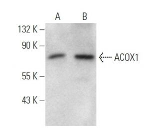ACOX1 Antibody (153CT43.1.1) - Western Blotting - Image 374575The Double Nickase Plasmid features a U6 promoter for sgRNA expression, a 20 nt targeting sequence, and a gRNA scaffold to guide Cas9n. It includes a CBh promoter for Cas9n (D10A) and puromycin resistance, GFP for transfection verification, and nuclear localization signals (NLS). The 2A peptide allows co-expression of Cas9n and Puro from a single promoter, enabling precise genome editing with reduced off-target effects.