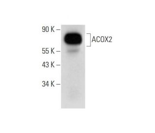 ACOX2 Antibody (D-10) - Western Blotting - Image 318463 