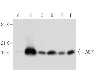 ACP1α Antibody (G-9) - Western Blotting - Image 304386