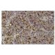 ACP2 Antibody (4B5) - Immunohistochemistry - Image 35979 