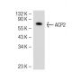 ACP2 Antibody (4B5) - Western Blotting - Image 51202 