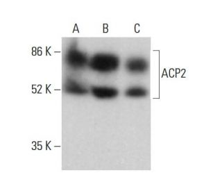 ACP2 Antibody (B-7) - Western Blotting - Image 377098 