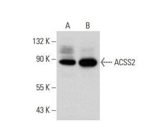 ACSS2 Antibody (A-9) - Western Blotting - Image 308356 