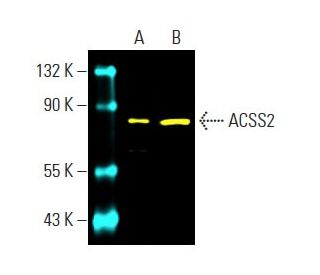 ACSS2 Antibody (A-9) - Western Blotting - Image 397456 