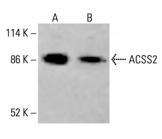 ACSS2 Antibody (A-9) - Western Blotting - Image 415487