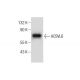 ACSVL6 Antibody (C-8) - Western Blotting - Image 284411