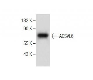 ACSVL6 Antibody (C-8) - Western Blotting - Image 284411SAM Transcription Activation: SAM system utilizing dCas9-VP64, MS2-P65-HSF1, and sgRNA for precise gene transcription activation.