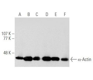 &alpha;-Actin Antibody (1A4) - Western Blotting - Image 356532 