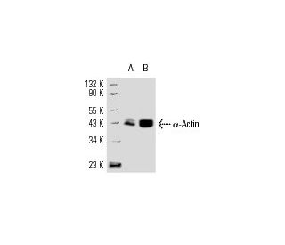 &alpha;-Actin Antibody (1A4) - Western Blotting - Image 9527 