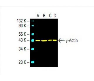 γ-Actin Antibody (1-17) - Western Blotting - Image 394256