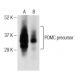 ACTH Antibody (2F6) - Western Blotting - Image 146434 