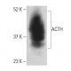 ACTH Antibody (2F6) - Western Blotting - Image 399439 