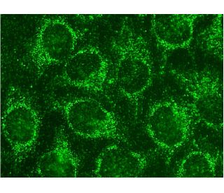 ACTH Antibody (HAT C22) - Immunofluorescence - Image 145141 