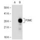 ACTH Antibody (HAT C22) - Western Blotting - Image 39397