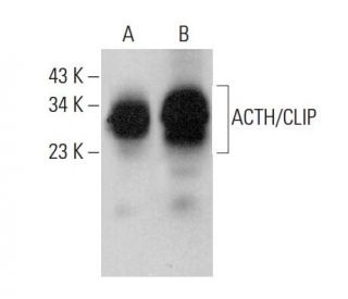 ACTH/CLIP Antibody (F-3) - Western Blotting - Image 378773 