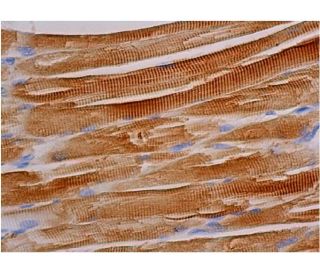 Actin Antibody (NH3) - Immunohistochemistry - Image 347945 