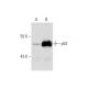 Actinomycin D: sc-200906. Western blot analysis of p53 expression in untreated (A) and Actinomycin D treated (B) MOLT-4 wh