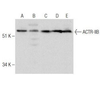 ACTR-IIB Antibody (ACEX12) - Western Blotting - Image 283571