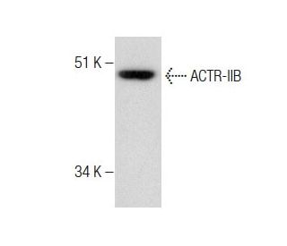 ACTR-IIB Antibody (G-7) - Western Blotting - Image 283572
