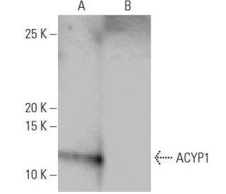 ACYP1 Antibody (2-RE16) - Western Blotting - Image 64823