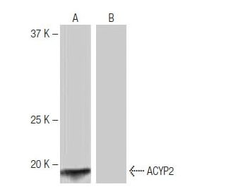ACYP2 Antibody (2B4) - Western Blotting - Image 64824