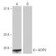 ACYP2 Antibody (2B4) - Western Blotting - Image 64824