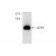 ACYP2 Antibody (B-3) - Western Blotting - Image 303858 