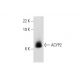 ACYP2 Antibody (B-3) - Western Blotting - Image 303889 