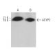 ACYP2 Antibody (B-3) - Western Blotting - Image 366777