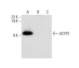 ACYP2 Antibody (G-5) - Western Blotting - Image 303468