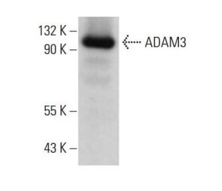 ADAM3 Antibody (F-4) - Western Blotting - Image 378207 