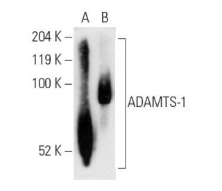 ADAMTS-1 Antibody (3E4C6B4) - Western Blotting - Image 12262