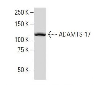 ADAMTS-17 Antibody (Q-12) - Western Blotting - Image 33851