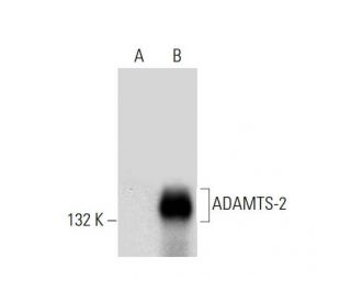 ADAMTS-2 Antibody (F-4) - Western Blotting - Image 297625