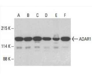 ADAR1 Antibody (D-8) - Western Blotting - Image 393056