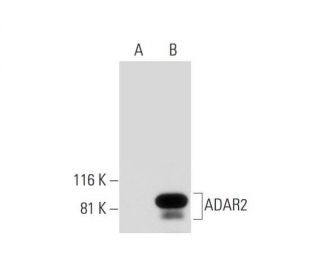 ADAR2 Antibody (A-5) - Western Blotting - Image 294454