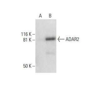 ADAR2 Antibody (F-9) - Western Blotting - Image 291870 