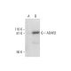ADAR2 Antibody (F-9) - Western Blotting - Image 291870 