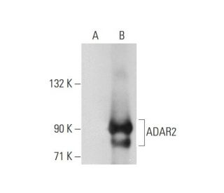 ADAR2 (1.3.1): sc-73409. Western blot analysis of ADAR2 expression in... 