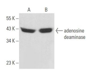 adenosine deaminase Antibody (D-4) - Western Blotting - Image 357179 